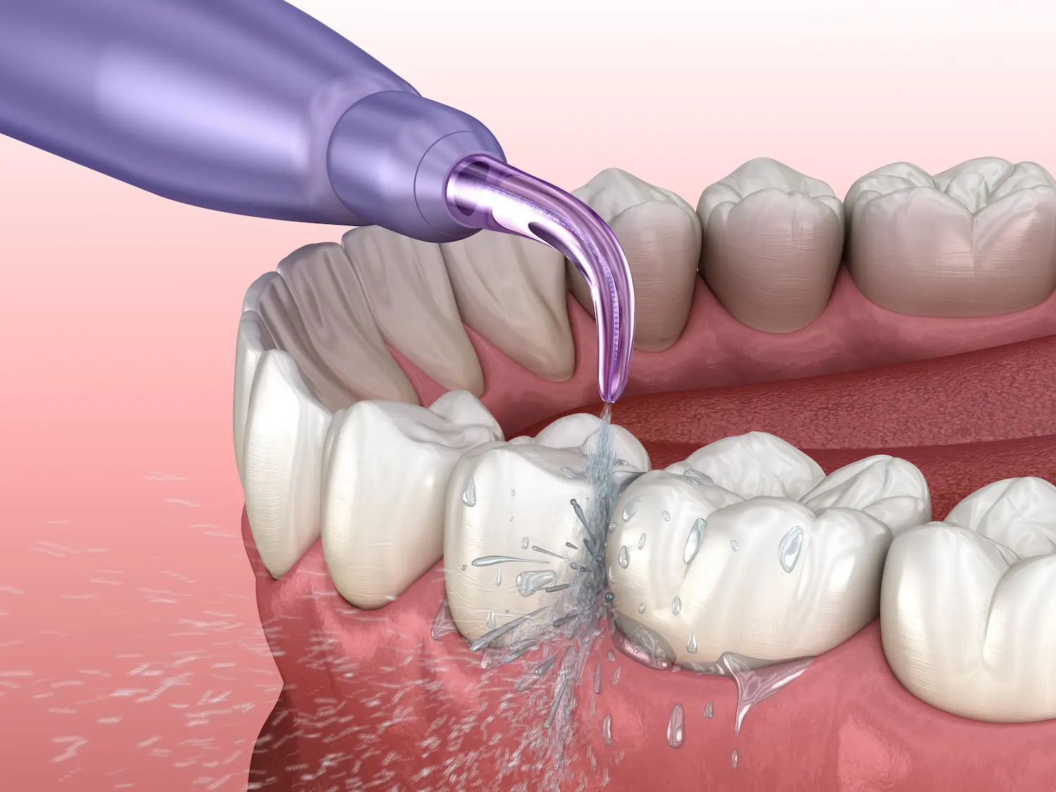 Teeth cleaning rinse